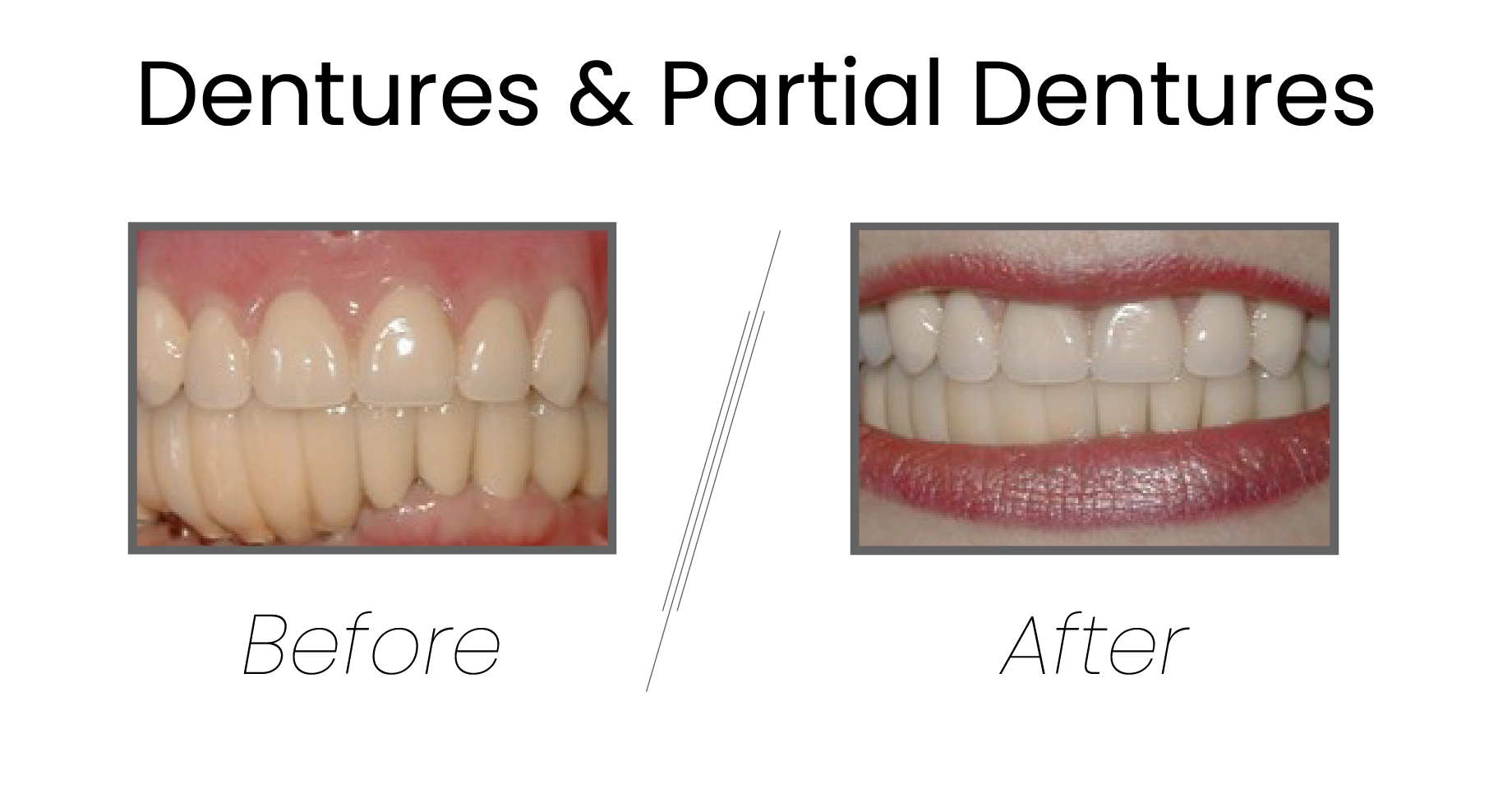 Before-After Images in the Smile Gallery of Gen Z Dentistry