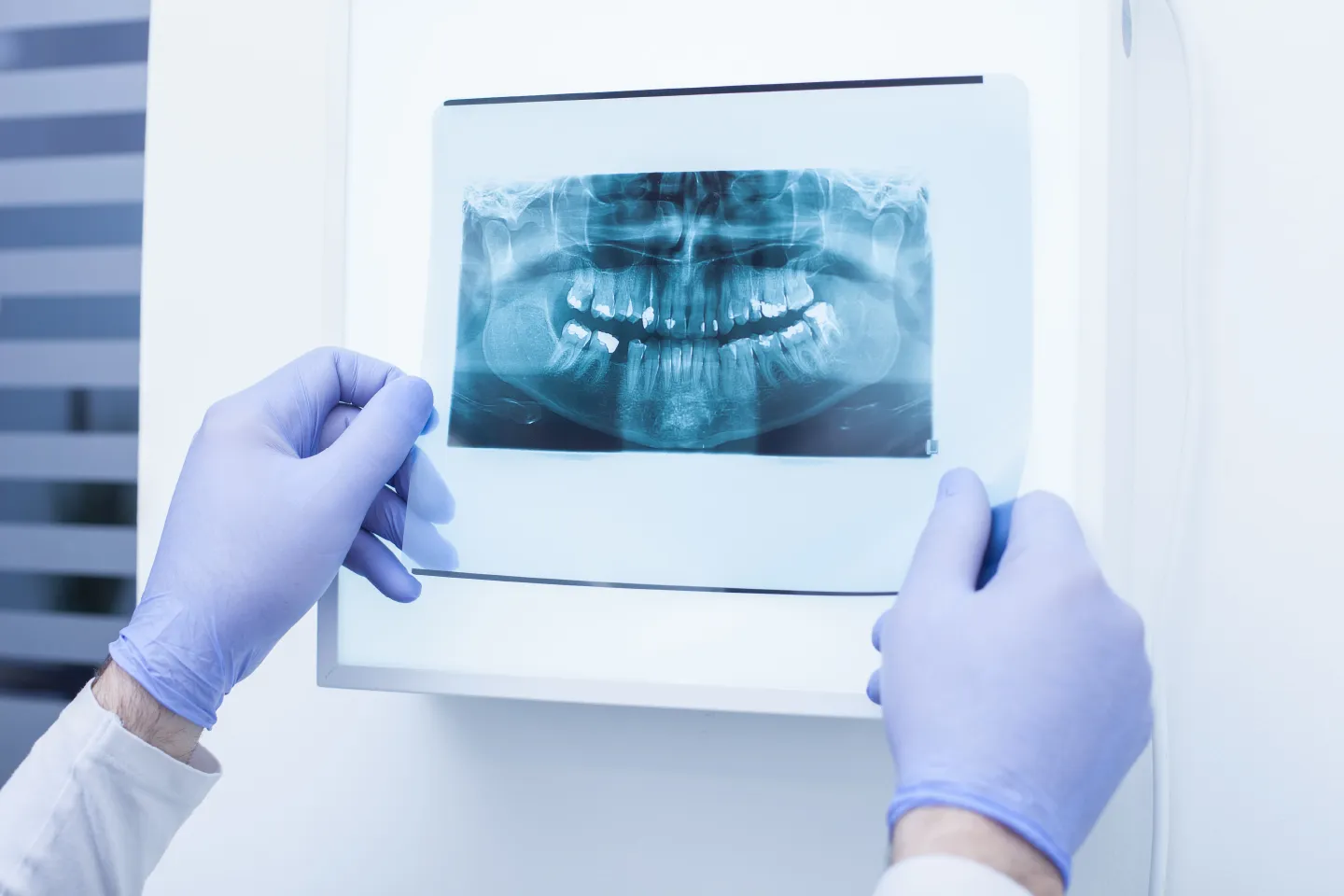 Dental X-Rays: Types, Uses, and Safety |  222 Main Street Dental of Milford
