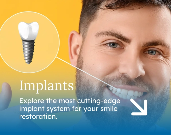 Implants