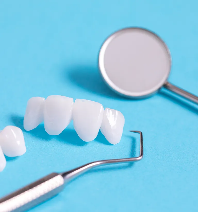 Veneers