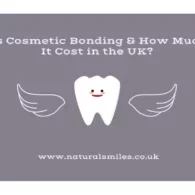 What Is Cosmetic Bonding & How Much Does It Cost in the UK?