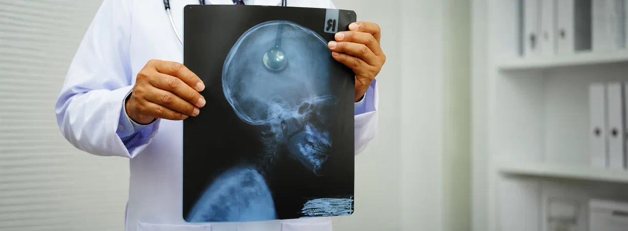 X-Ray