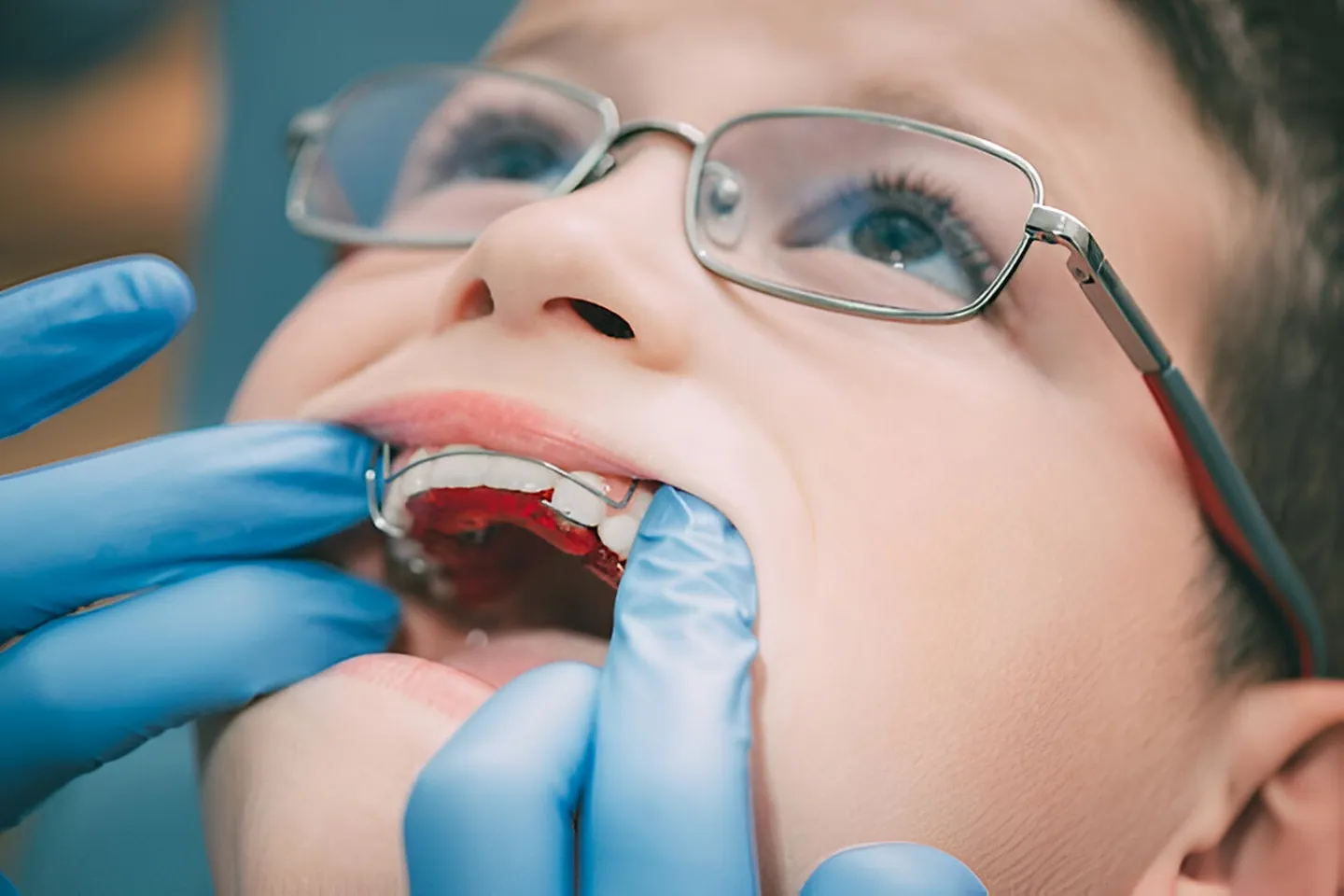 What Does Technology Have to Do With Braces