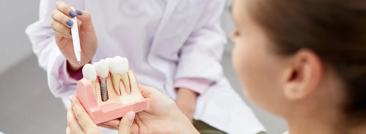 Dental Implants
